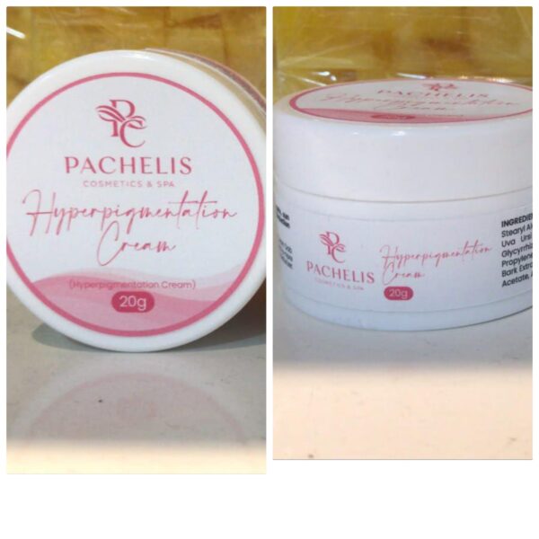 hyperpigmentation face cream